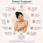 blueberry eczema